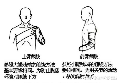 (图为大腿残肢弹力带包扎方法)(图为小腿残肢弹力带包扎方法)一,弹力