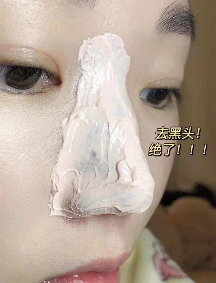 去黑头收缩毛孔的最好方法