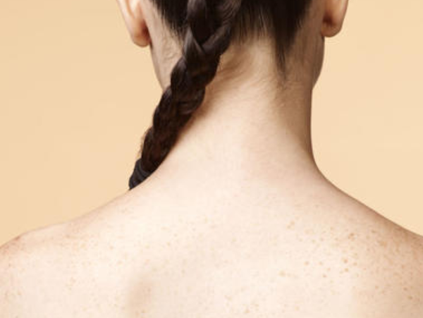 肩膀背部的鸡皮疙瘩痒痒(后背痒起鸡皮疙瘩越挠越痒) 肩膀背部的鸡皮疙瘩痒痒(后背痒起鸡皮疙瘩越挠越痒)