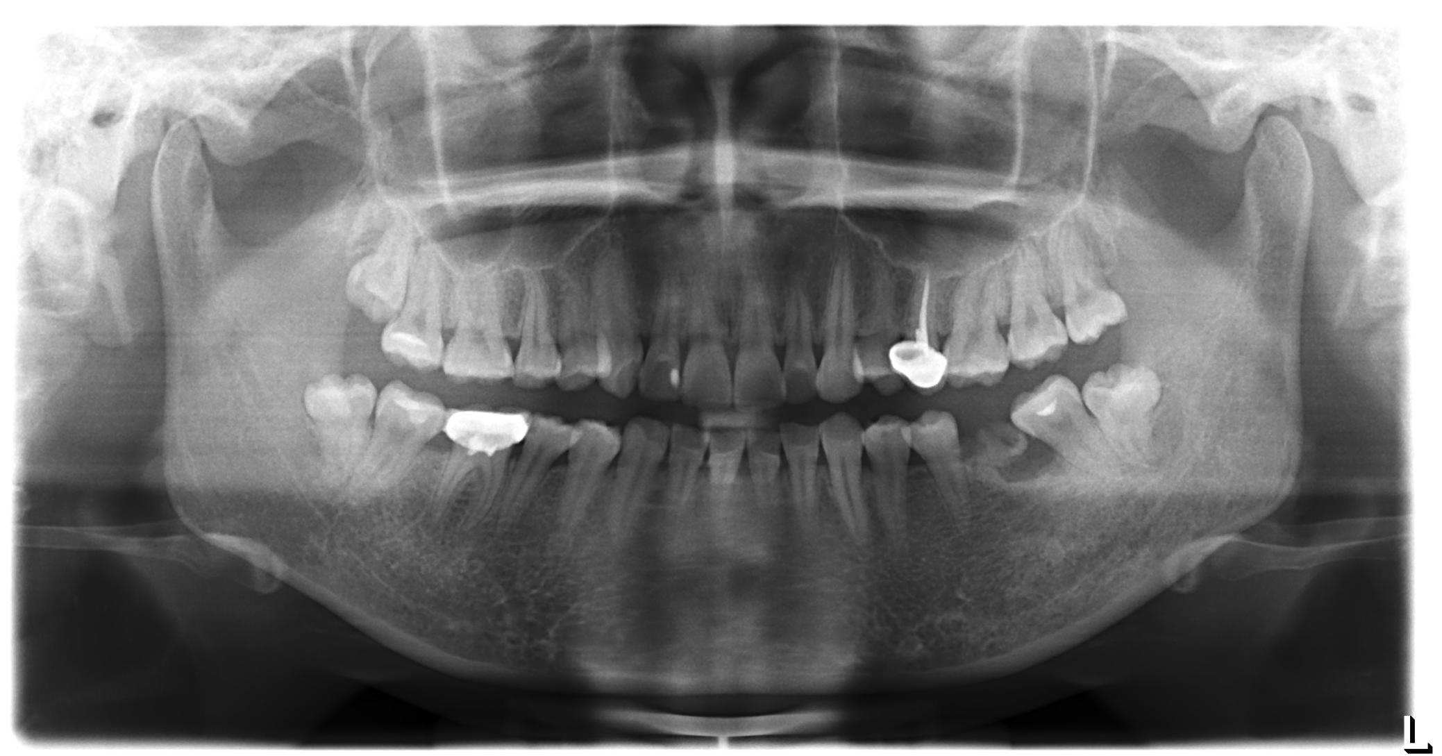 149.牙的构造 (模式图)-基础医学-医学