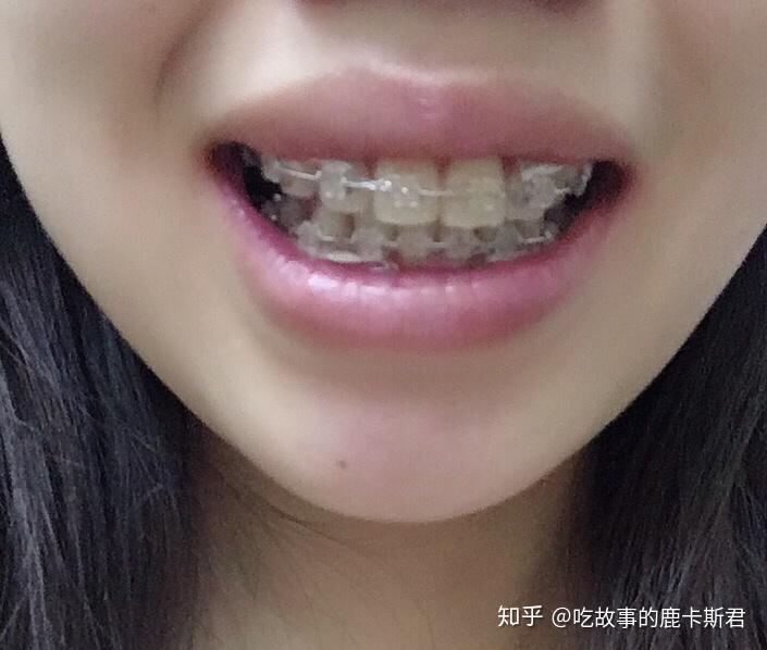 v2-6708d1fec1090dc070db8ea6ead55c49_r.jpg