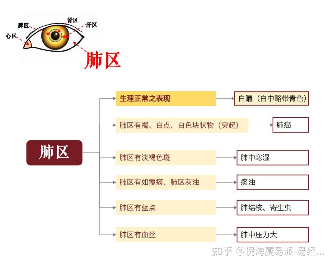 倪海厦中医的眼诊法简介:倪老师的眼睛里面的诊断法是根据五行相克