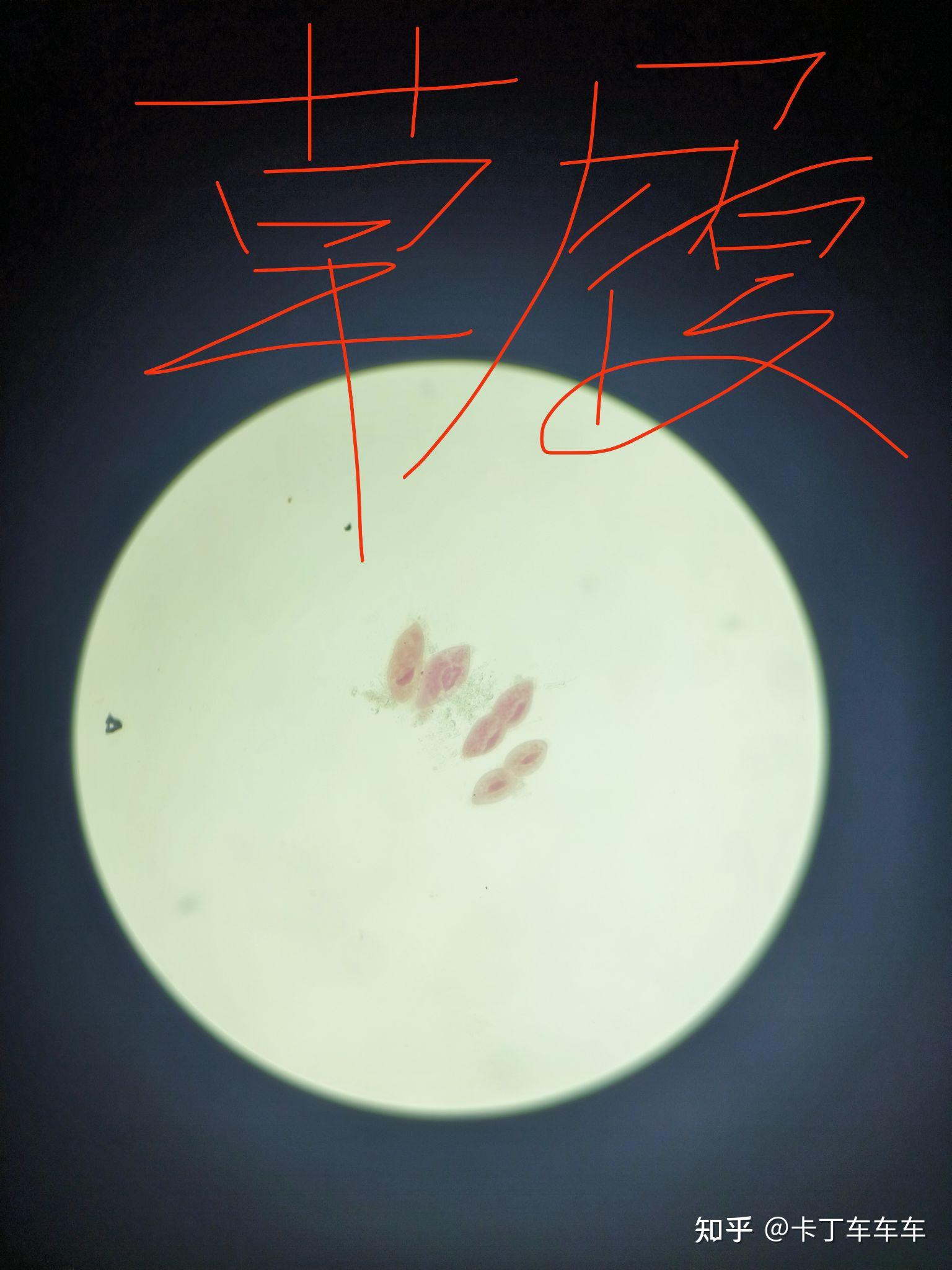 绘制眼虫和草履虫的结构图