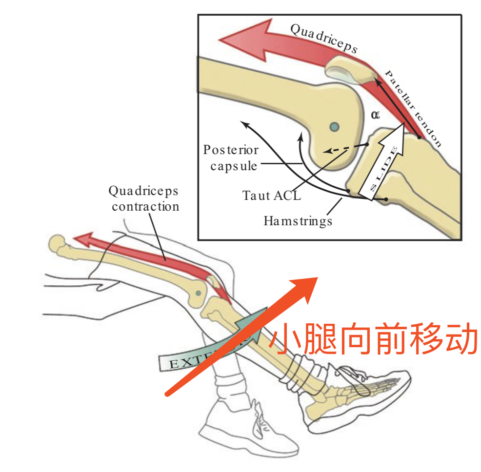 301醫院的醫生說要練靜蹲,要利用大腿前側(股四頭肌)分擔前交叉韌帶