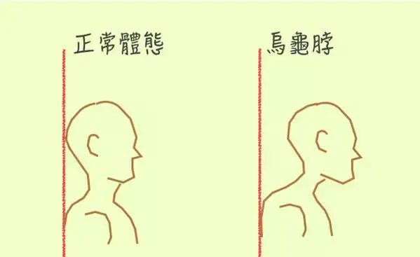 杨幂赵丽颖统统躺枪脖子前倾毁了无数人你的猥琐还有救吗