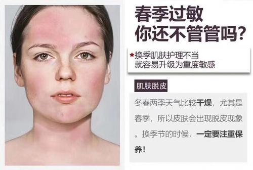 什么是春敏呢怎么解决春季易敏问题