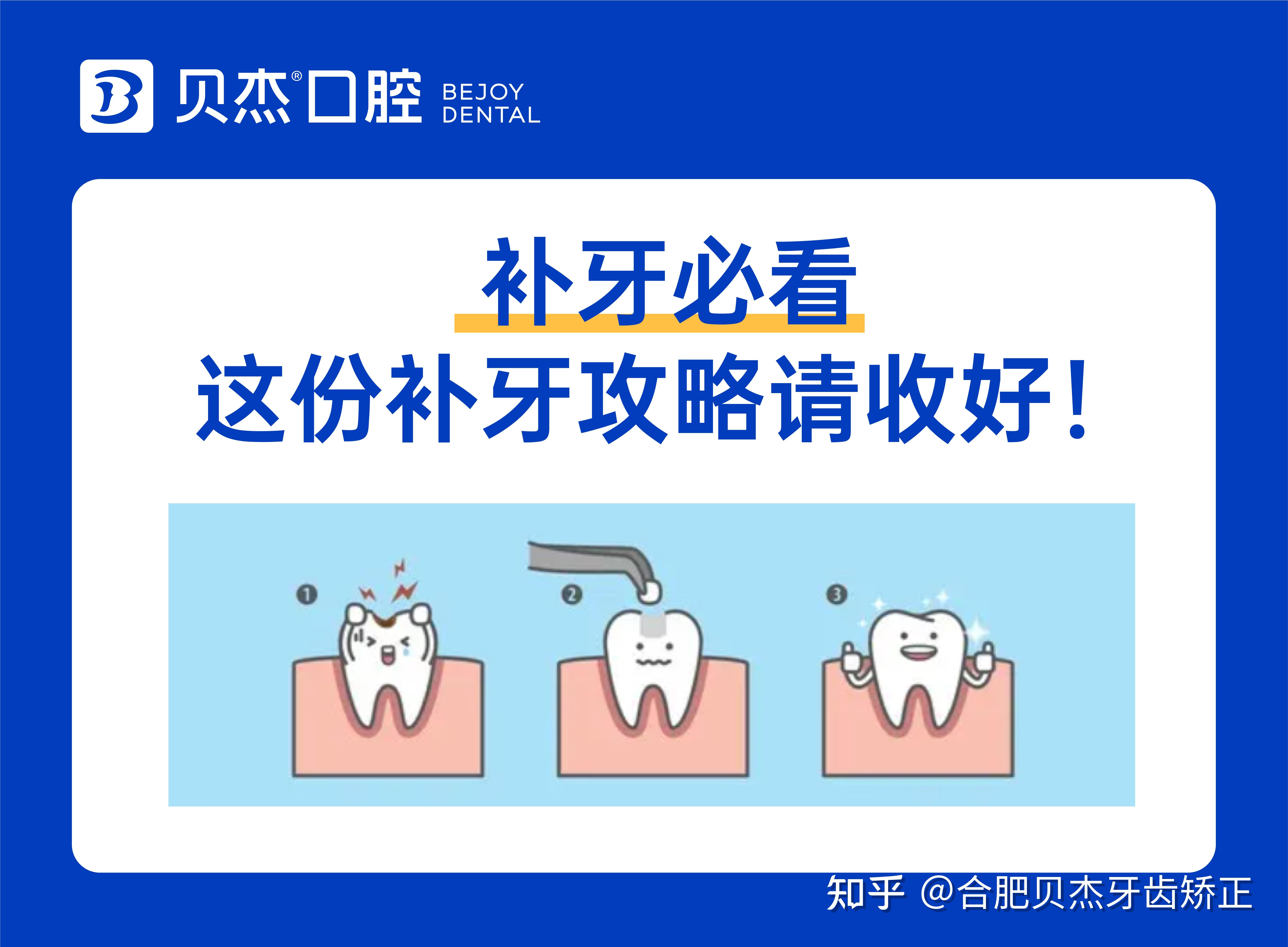 评论区经常有人留言: 什么样的牙齿需要补?不及时补牙有什么危害?