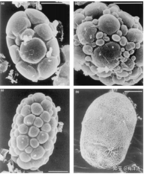 “重度结石细菌”——小石子细菌Achromatium(2)
