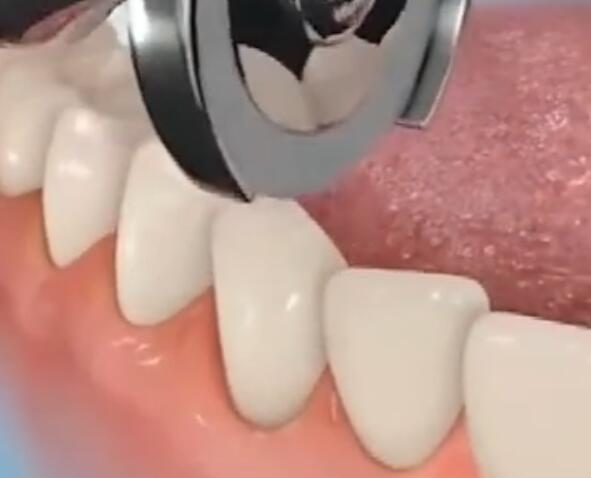 v2-688f312c8c9e204f7c17b73382b463d1_1440w.jpg?source=172ae18b