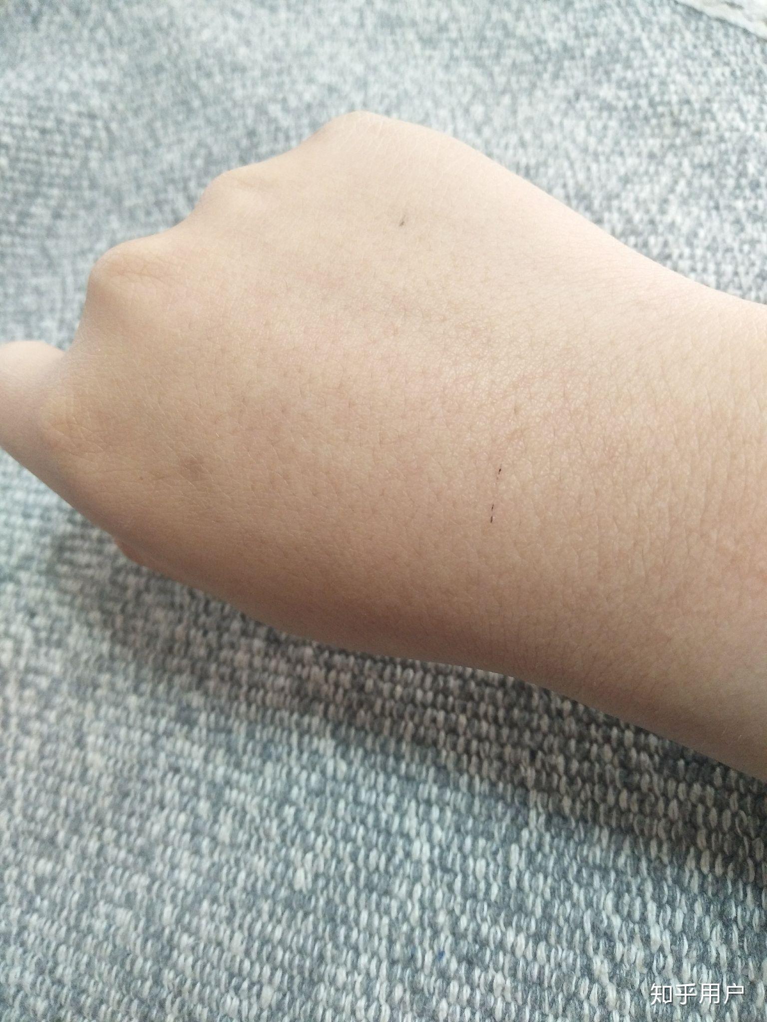 我是女生手背上汗毛很多毛孔特别大密密麻麻的大家有紧毛孔的办法吗