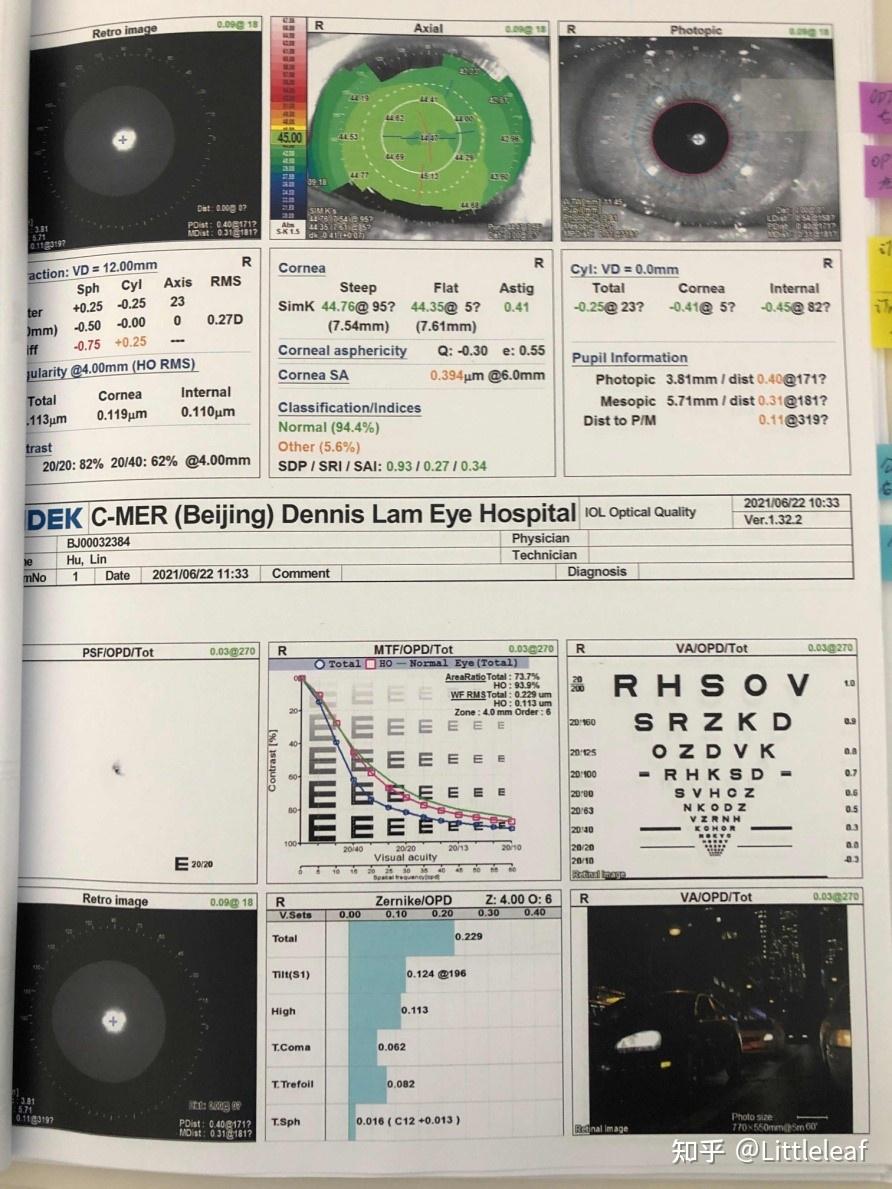 眼科OPD怎么读图希玛眼科医院再添“利器”助力屈光性白内障手术_https://www.jmylbn.com_新闻资讯_第5张