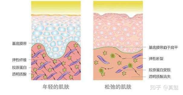 先來點常識,我們知道,皮膚分為表皮,真皮和皮下組織.