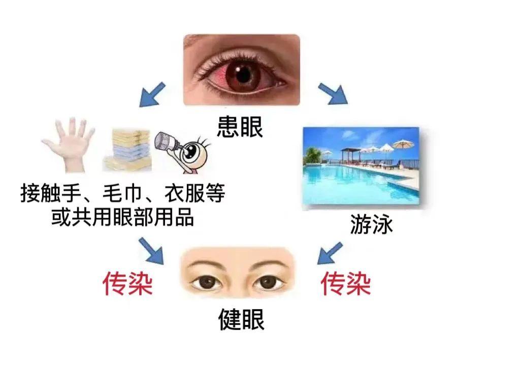 红眼病的原因图片