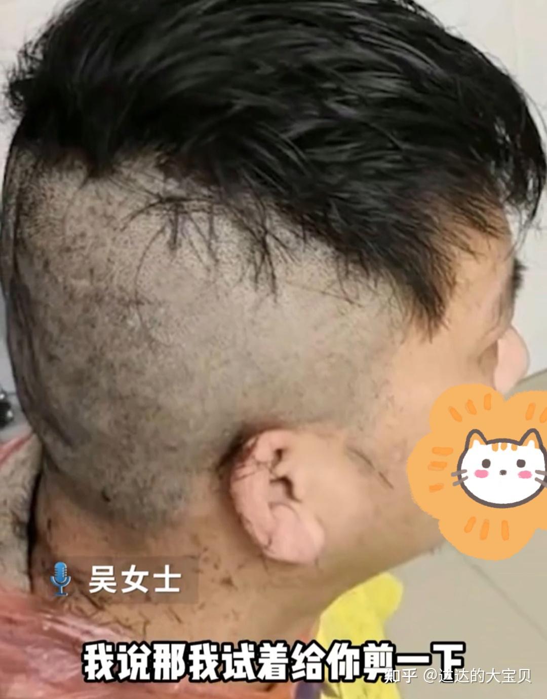 吴女士给丈夫剪了左边的头发,又赶紧修理他右边的头发,右边的头发修完