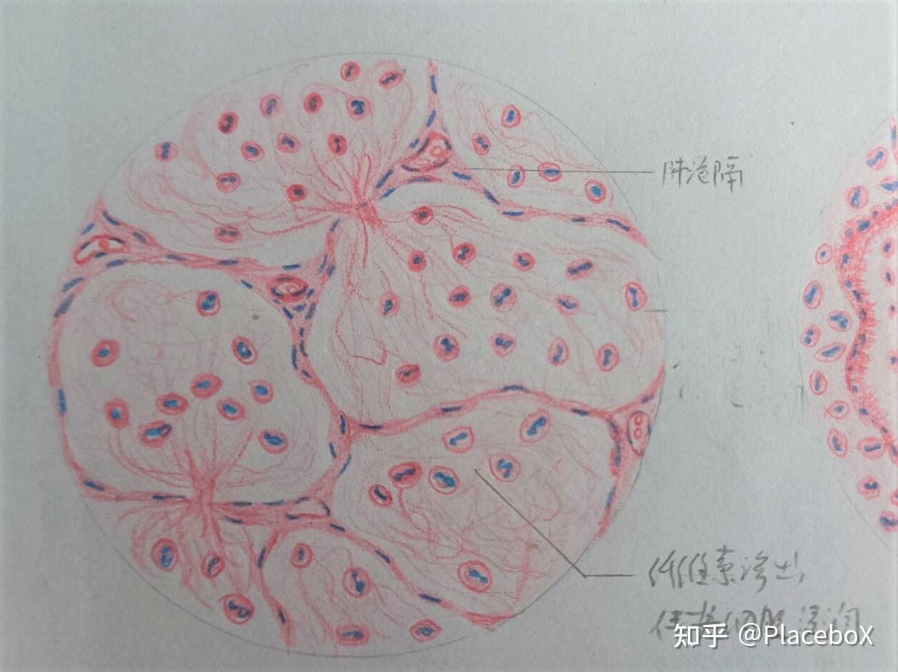 肺组织切片红蓝铅笔图图片