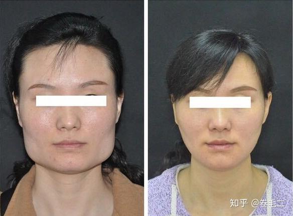 人口五官_人口普查图片(2)