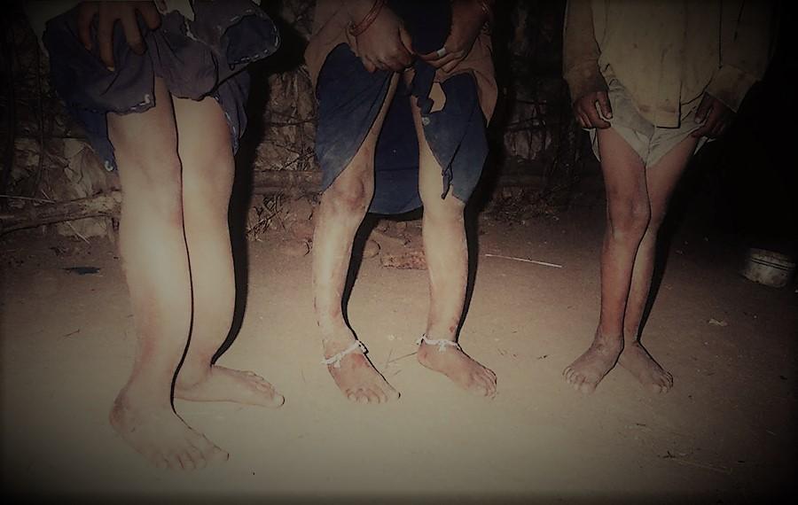 你在给宝宝使用含氟牙膏吗请谨慎尤其是高氟地区不宜使用