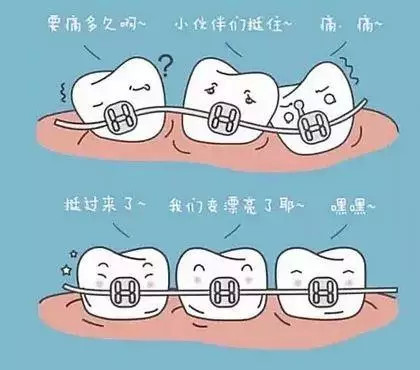 阜阳科普牙齿矫正小知识