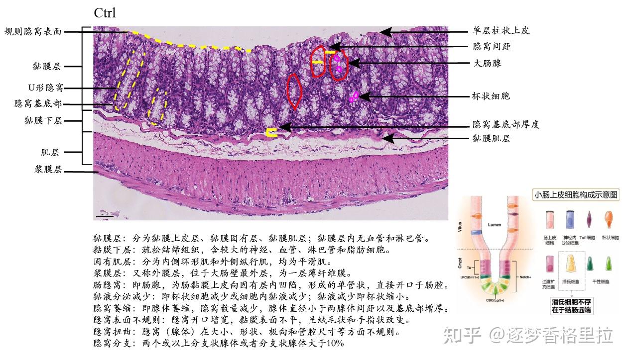结肠组织切片图图片