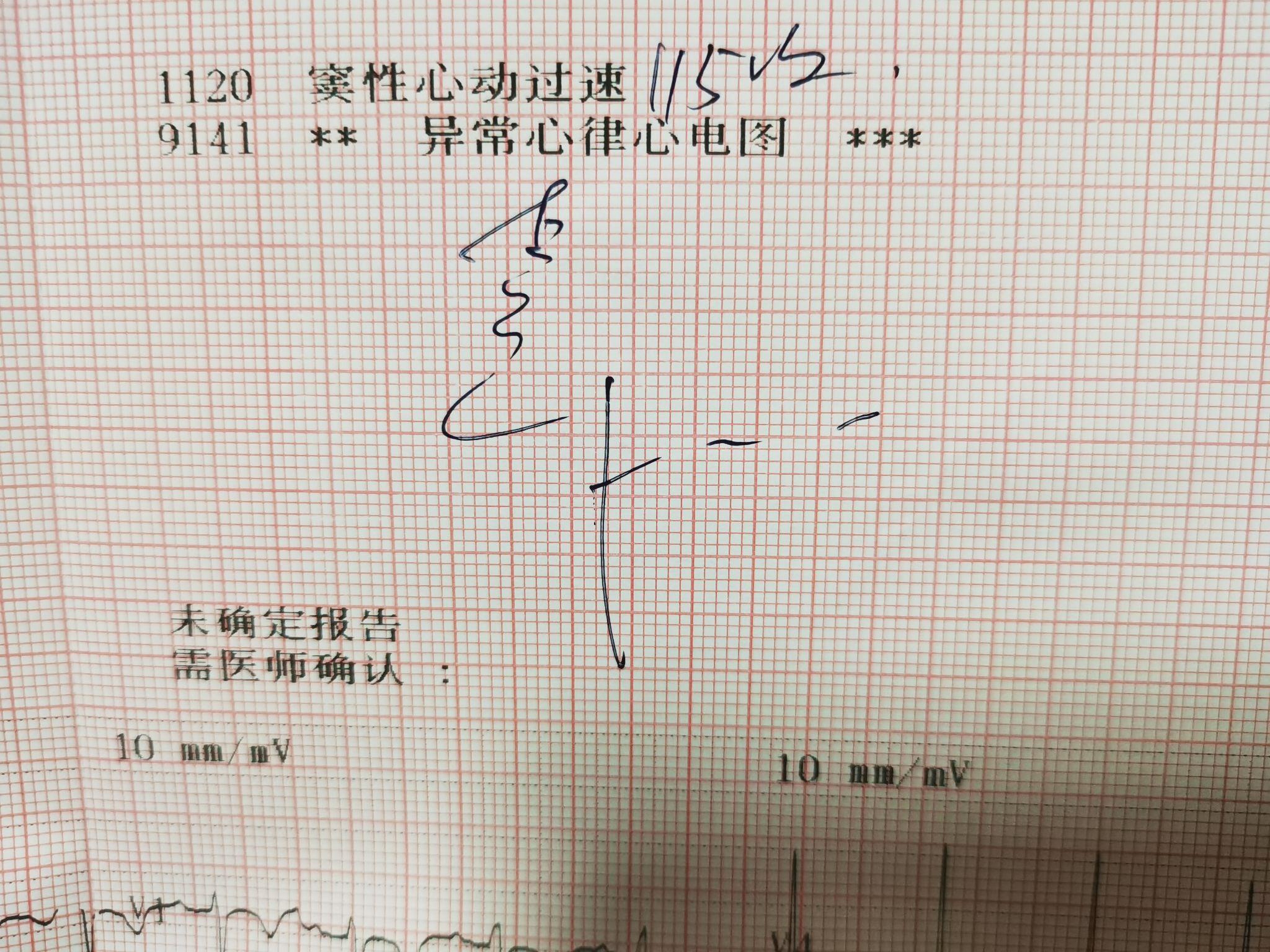 什么是双相躯体化 v2-69f422a30ac7fde87e4fb177fbbf5f62_r.jpg