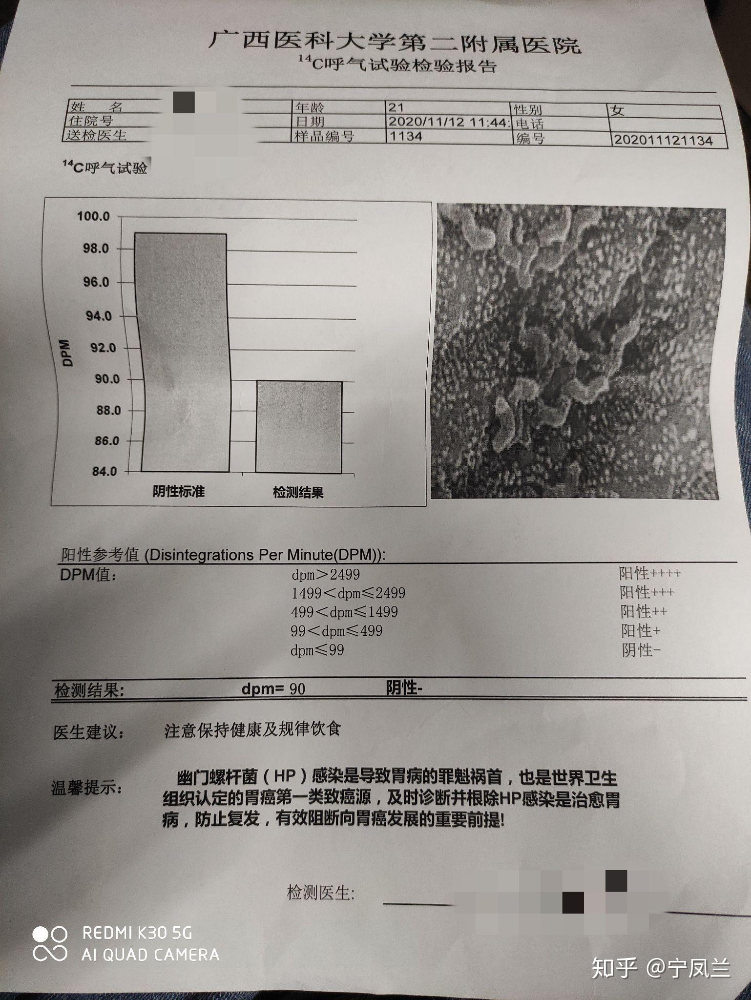 图四:c14幽门螺旋杆菌呼气测试报告图五:胃镜检查报告