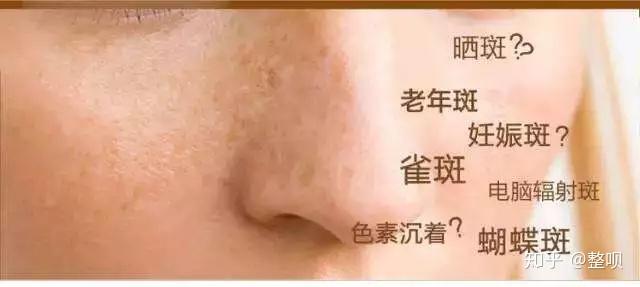 v2-6a85eb8177d412ac2d166d3fe2cd09c9_r.jpg