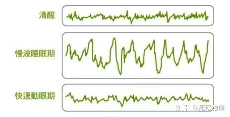 慢波睡眠(sws)的作用主要是帮助恢复体力,促进生长发育,属于深度睡眠