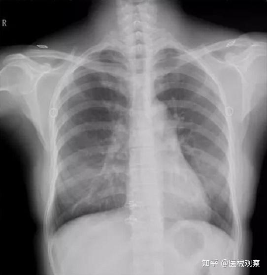 从技术的角度谈谈为什么看好动态DR技术 - 知乎