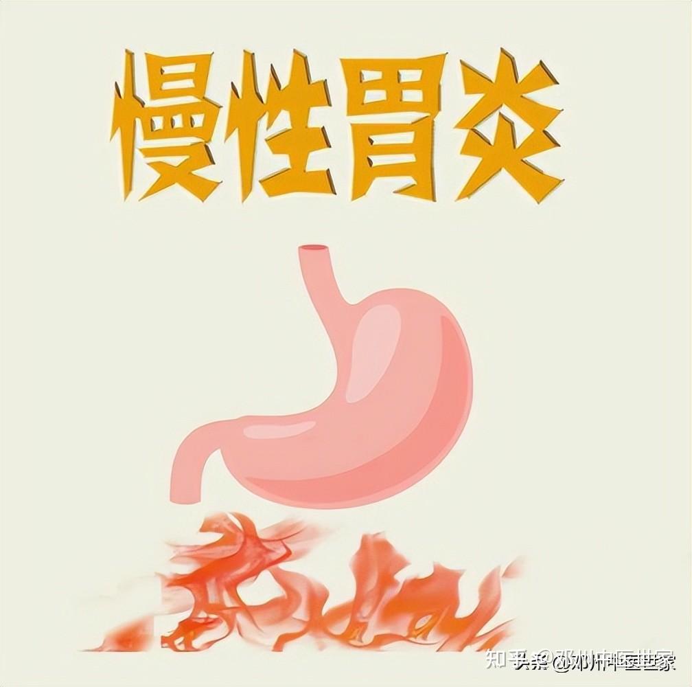 慢性胃炎、寒热错杂型(上热下寒)型中医中药治疗验方 - 知乎