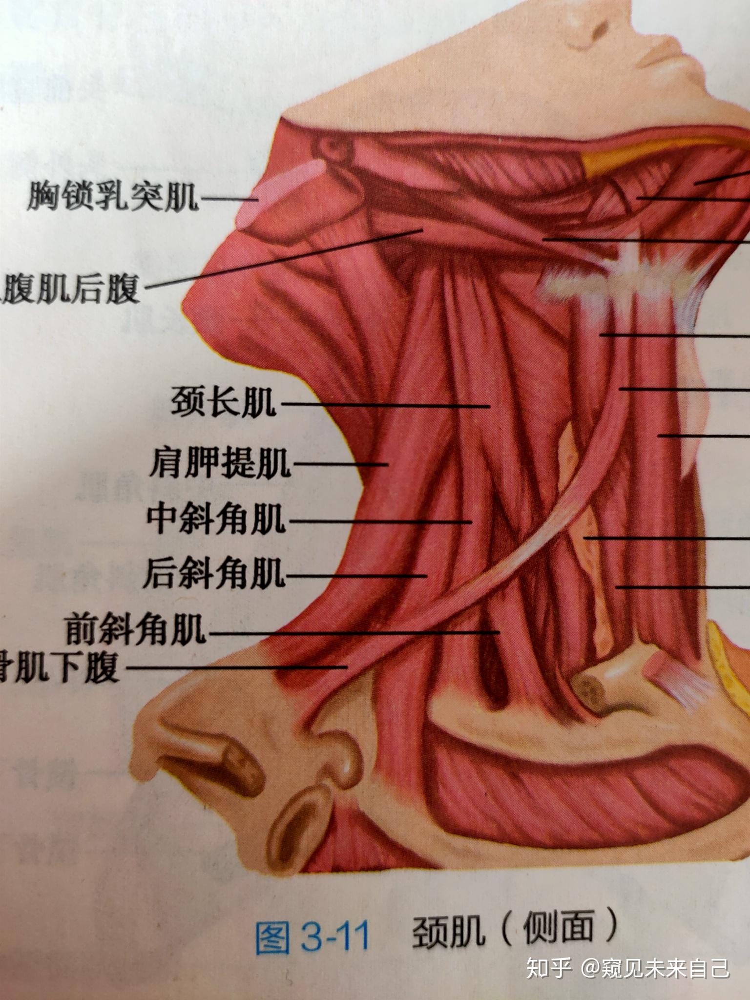 胸锁乳突肌前后缘图片