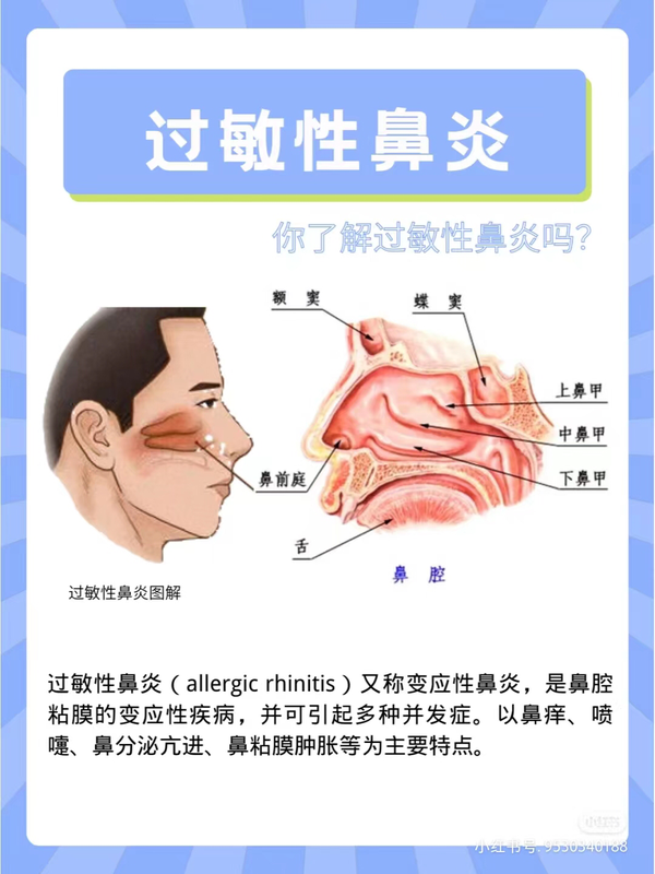 普通慢性鼻炎、鼻窦炎如何治疗？ - 知乎
