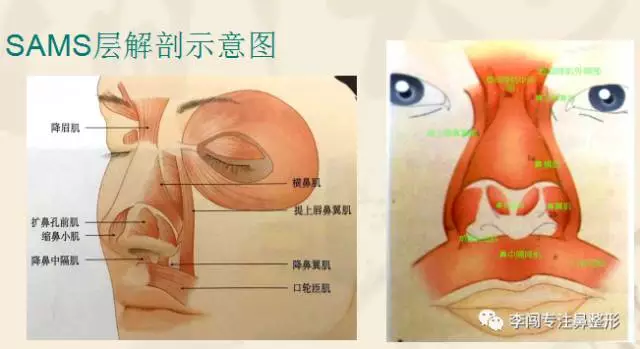 鼻子的软组织:从解剖学来说,鼻部皮肤与骨,软骨之间分为四层:薄脂肪层