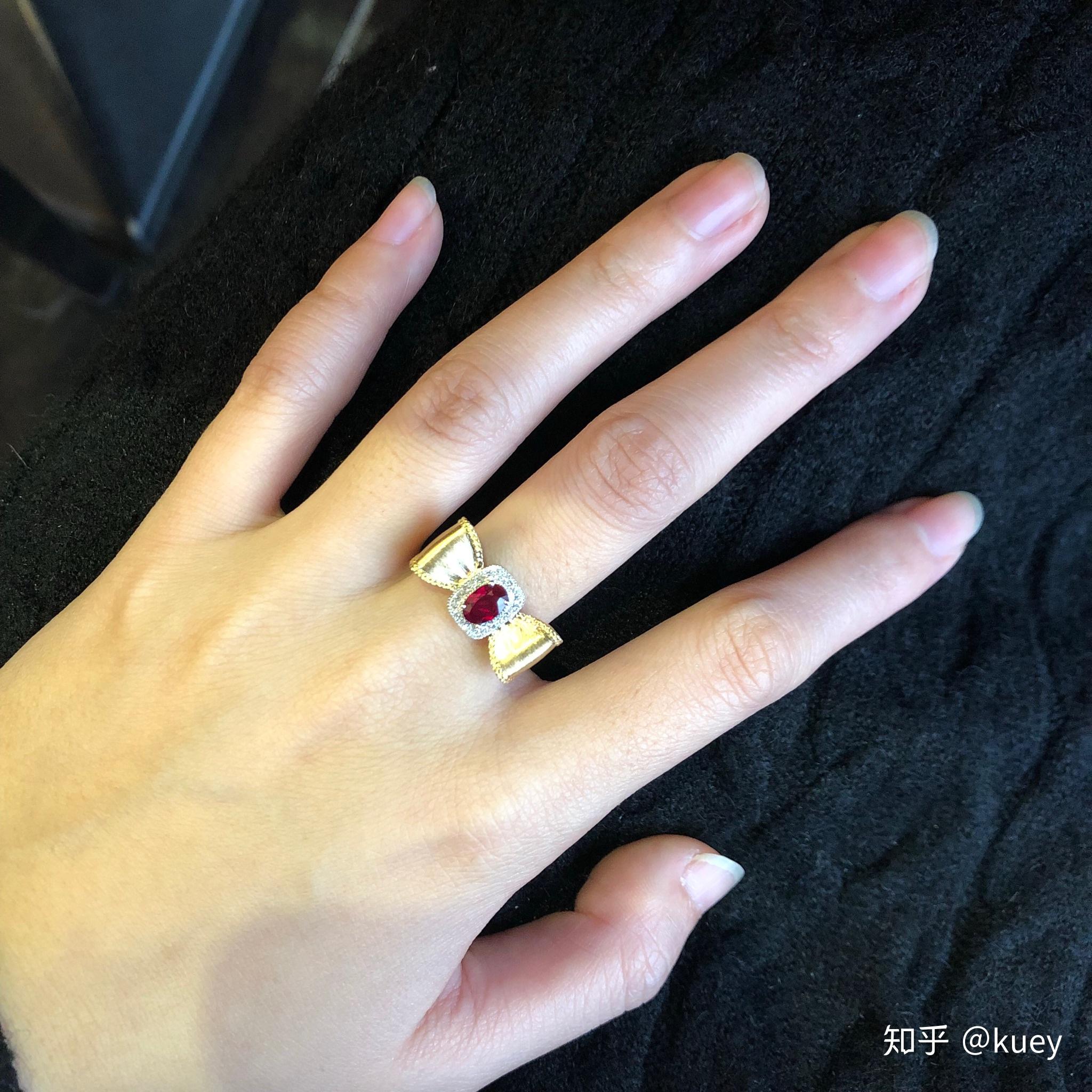 为什么我的大拇指又宽又短?