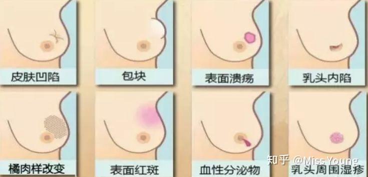 妇科检查用什么器妇科检查有哪些项目需要做呢？大概多少钱？_https://www.jmylbn.com_新闻资讯_第2张