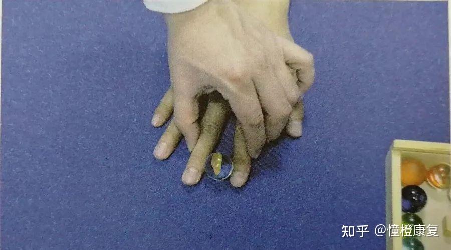 有效促进偏瘫上肢及手功能康复的7种训练方法 知乎 