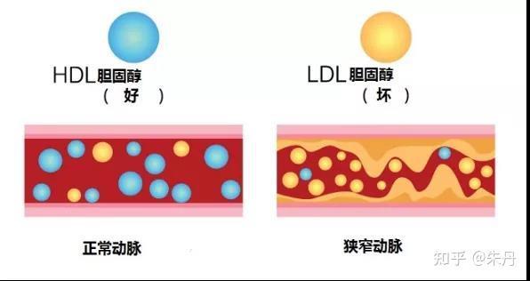 尿酸和甘油三酯高不能吃什么_能尿酸吃甘油三酯高的药吗_甘油三酯和尿酸高能吃什么