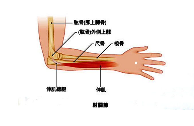 mills征阳性图片