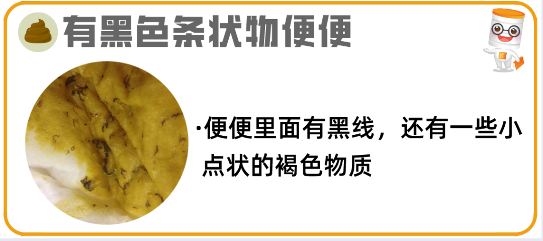 逾20种宝宝大便图片详解!最后10种必须警惕! - 知乎