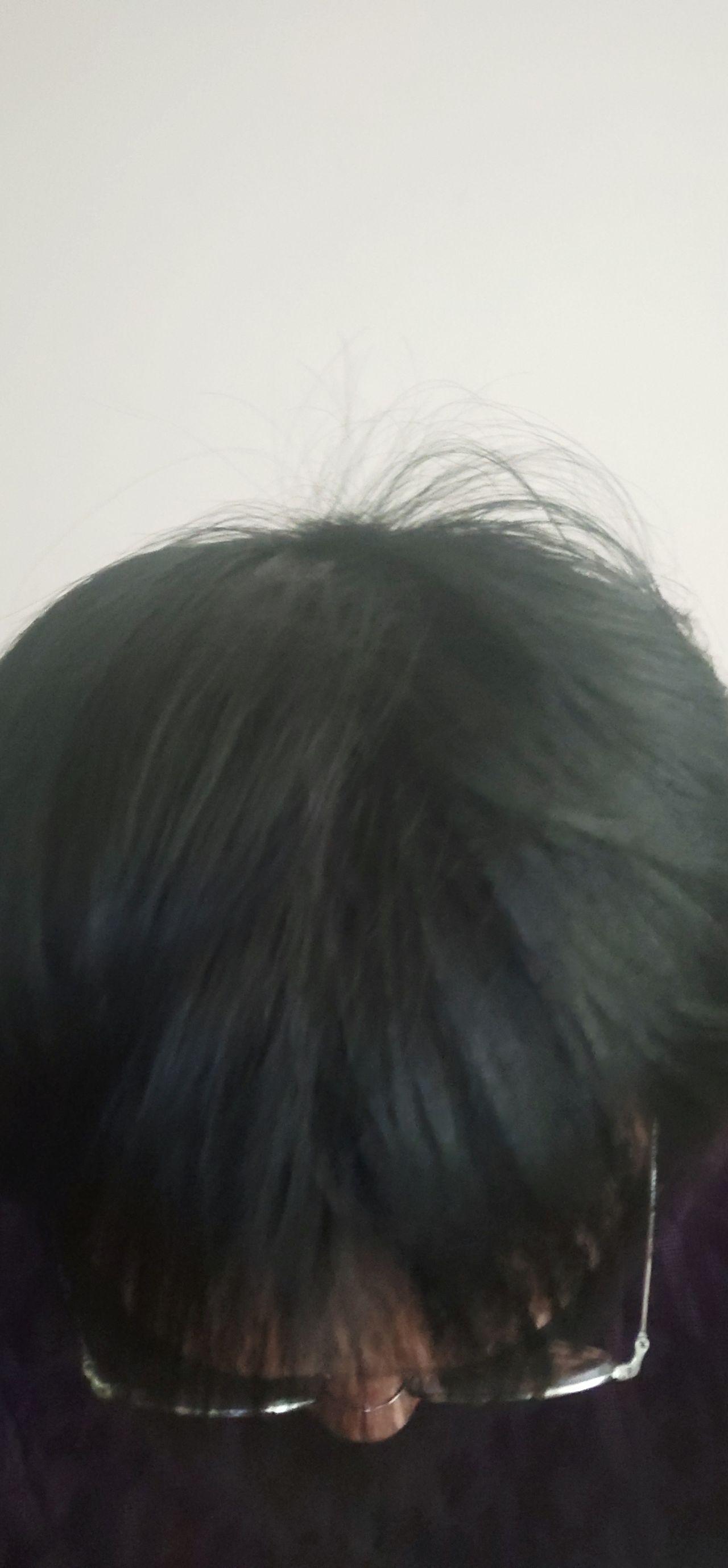 ریختن مو در خانمها: نازک شدن مو علتها و شیوه های درمان