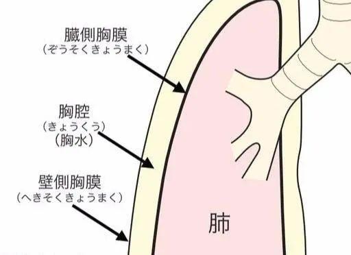 最全攻略肺癌引起的胸水如何治疗