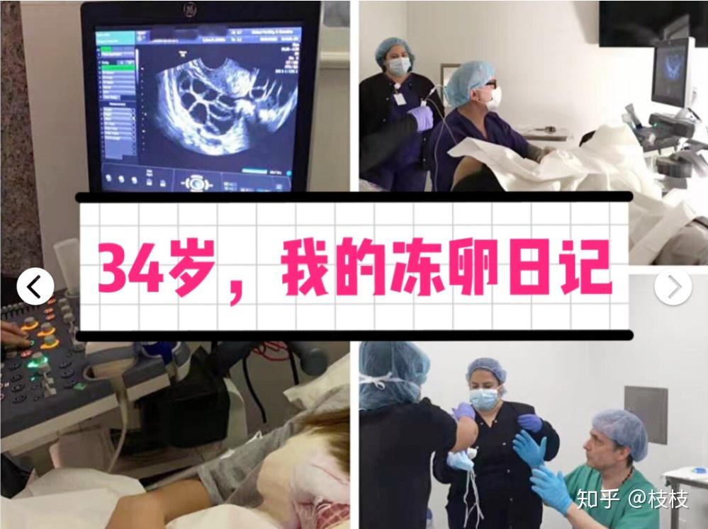 34岁我去美国冻卵了