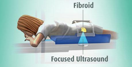 HIFU聚焦超声波治疗现在在临床上到底是什么