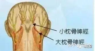 关于枕神经痛,你需要了解什么? - 知乎