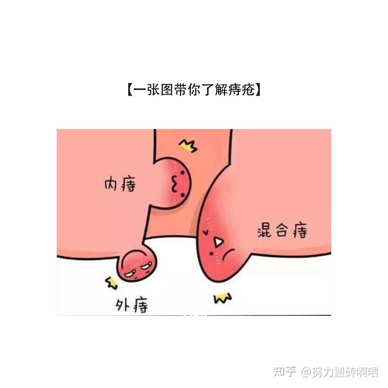 痔疮是软的还是硬的图片