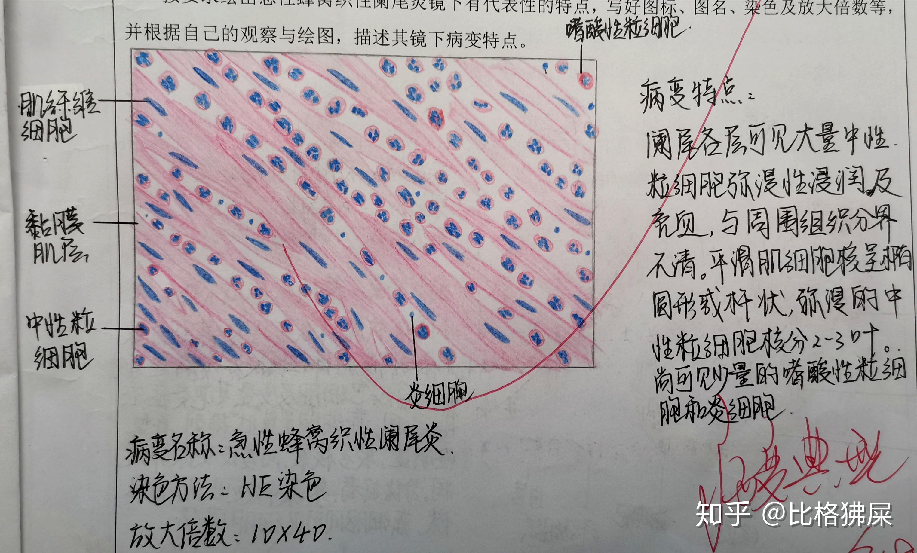 慢性肝淤血10×40绘图要点:严重淤血区即靠近中央静脉地方,绘出红细胞
