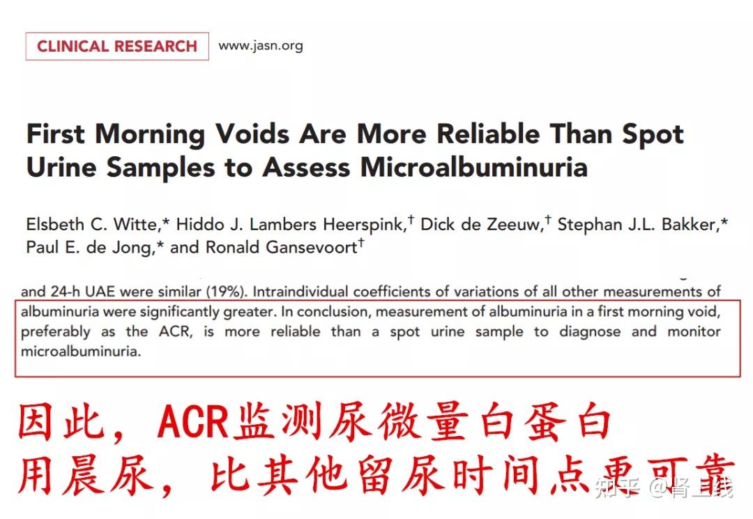 24小时尿蛋白留起来太麻烦？ACR和PCR了解一下！ - 知乎