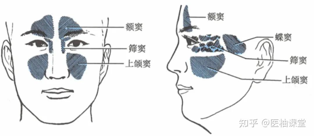 上颌窦有几个壁? - 知乎