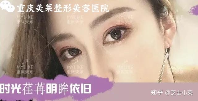 眼睛是腫眼泡怎麼破能消除嗎