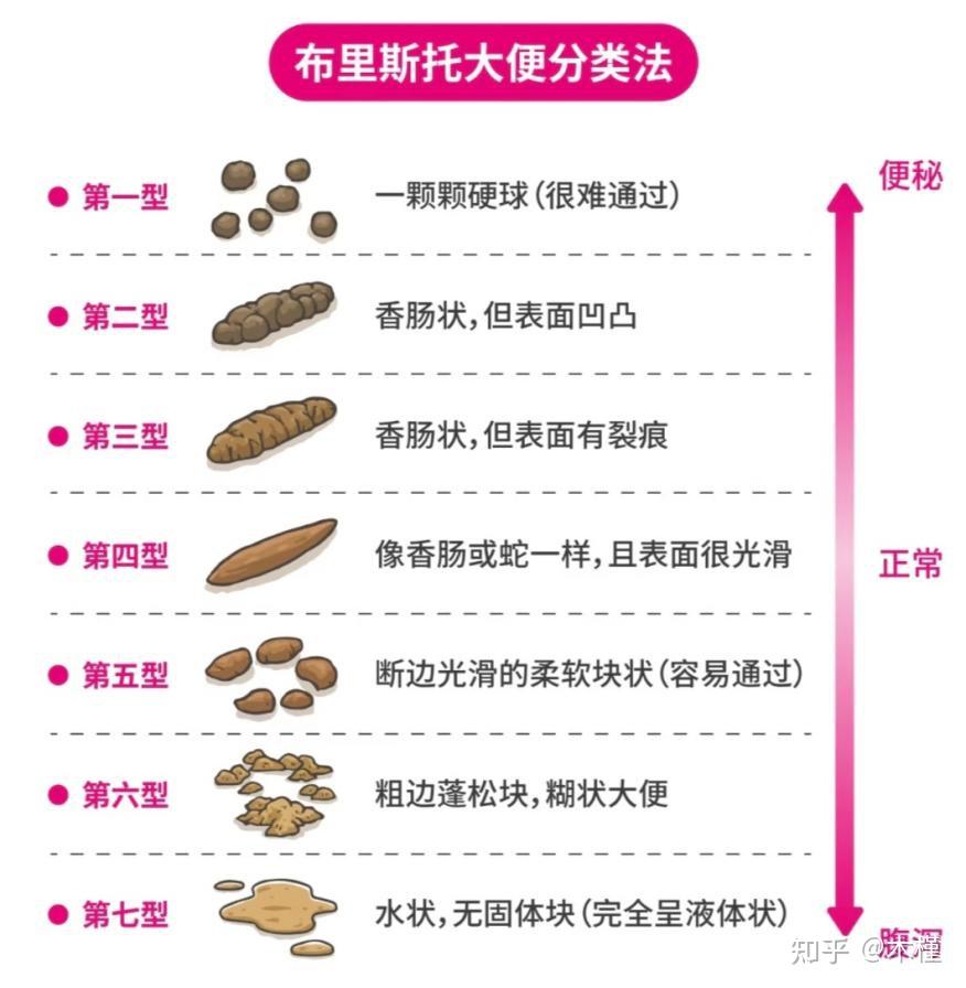 关于顺利排便的一切，看完这篇省下90%搜索时间 - 知乎