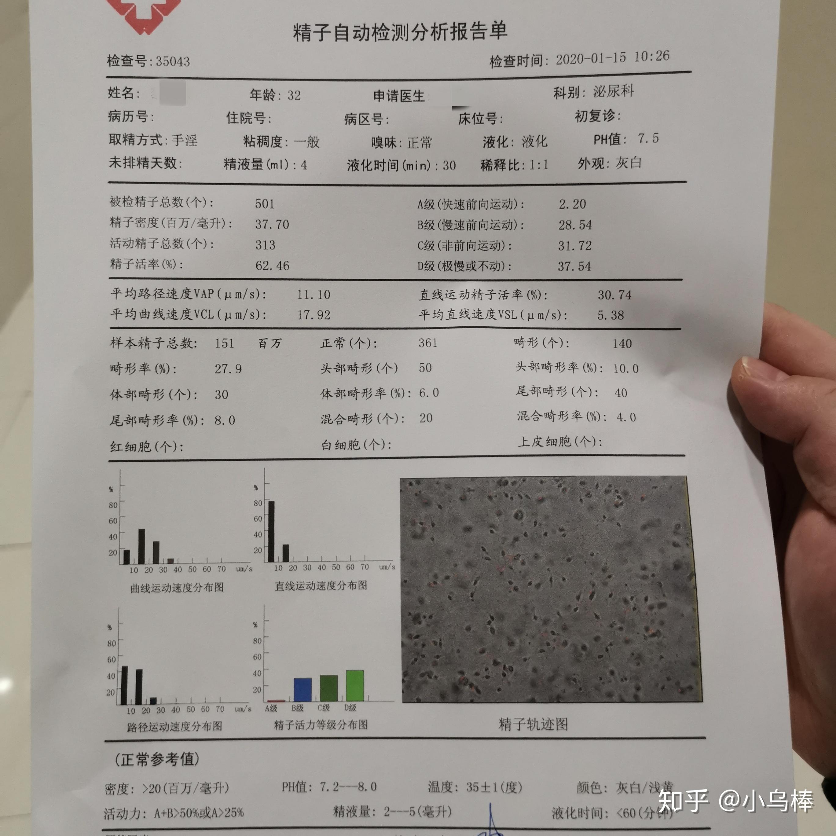 怎样看前列腺液化验单图片